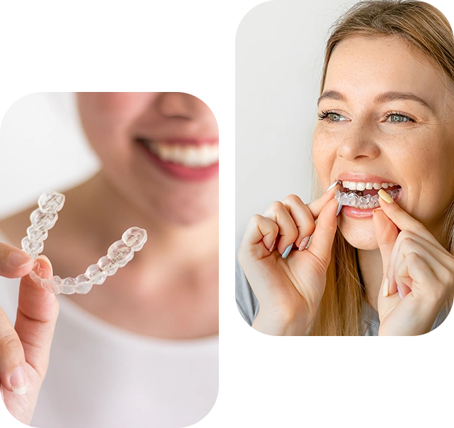 Dental Braces in London image