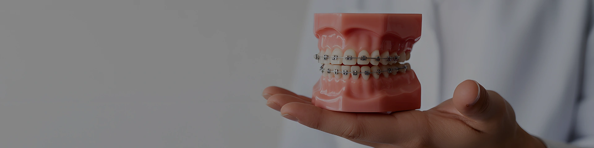 Denture Banner image - Chatfield Dental Braces