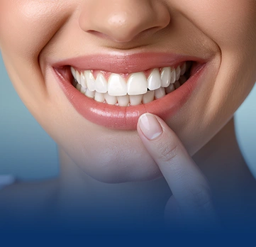 Teeth Whitening treatment image - Chatfield Dental Braces