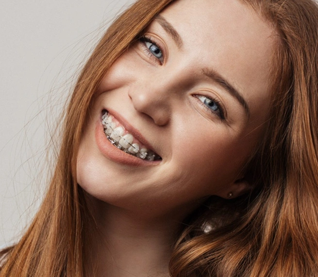 Differences between clear braces and invisible braces.