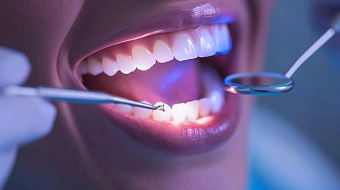 Composite bonding cost in London image