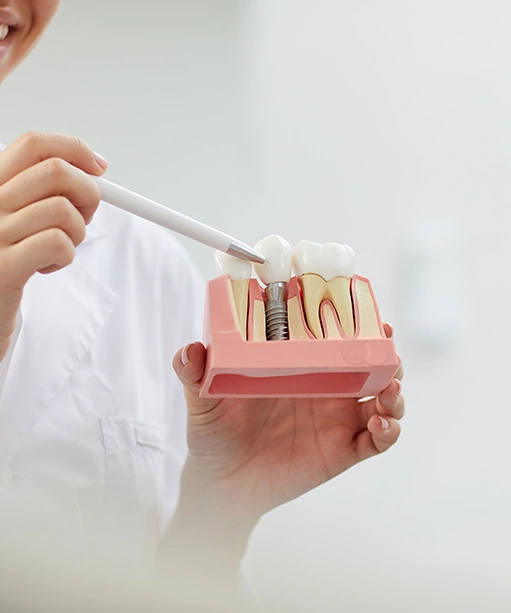 London Affordable Dental Implants