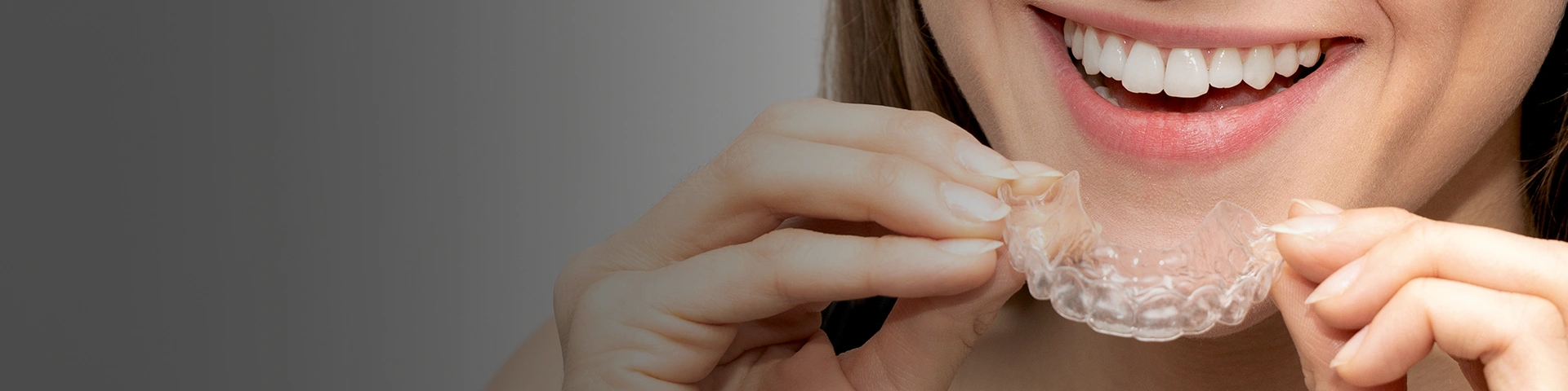 Invisalign Treatment Banner image