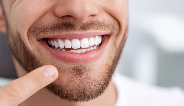 Invisalign deals in London at Chatfield Dental Braces