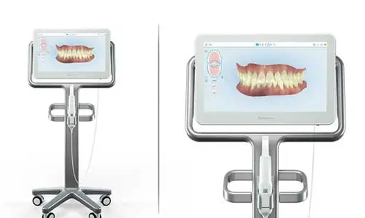 iTero intraoral 3D scanner at Chatfield Dental Braces