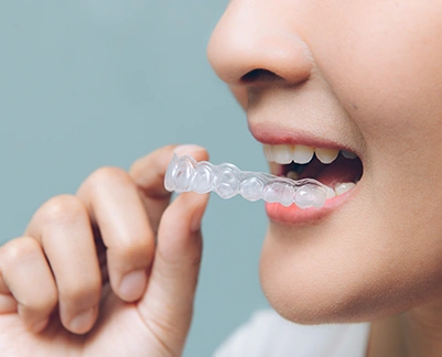 Orthodontics Clear Braces at Chatfield Dental Braces In London