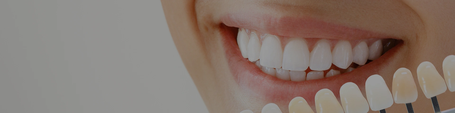 Teeth Whitening Banner Image