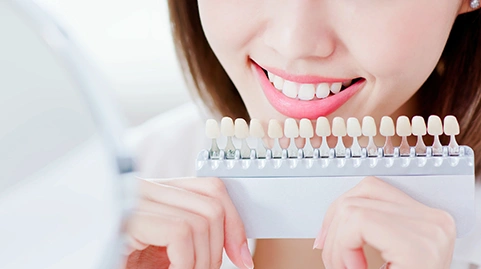 Teeth Whitening Cost in London, UK