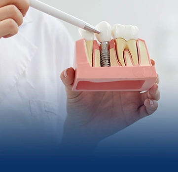 Tooth Implant at Chatfield Dental Braces