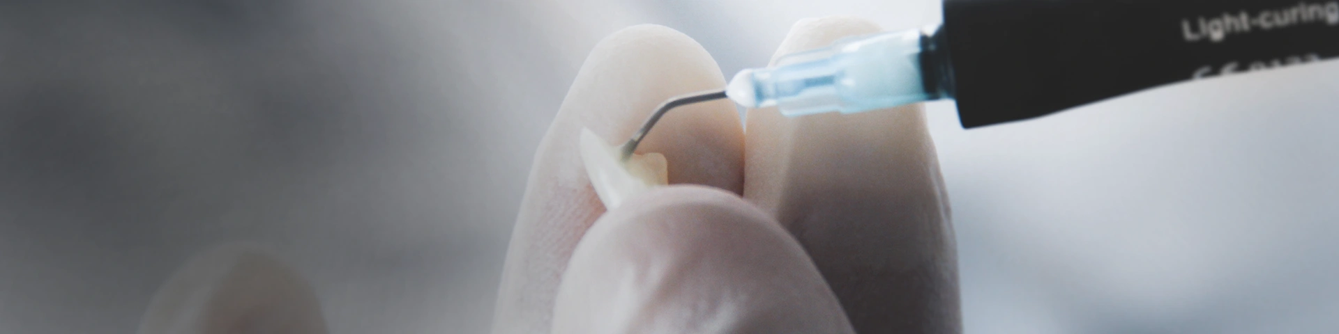 Veneers in London banner Image