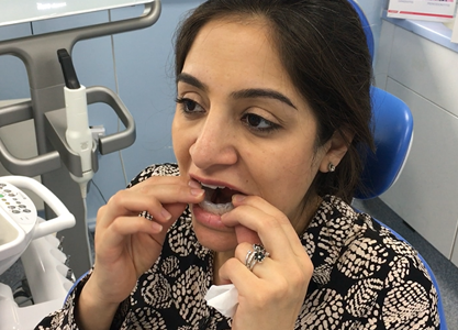 Invisalign case study image - Chatfield Dental Braces