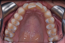 Invisalign Dentist London Image 01