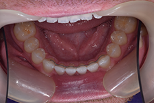 Invisalign Dentist London Image 32