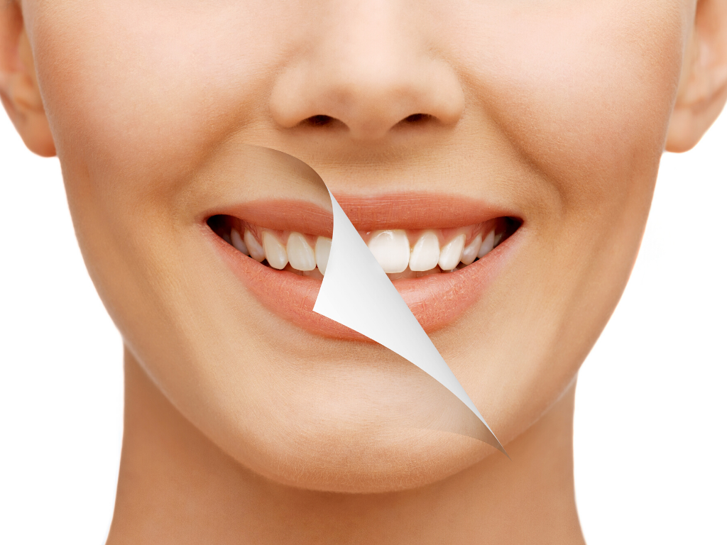 Myths and Truths about Teeth Whitening Treatment