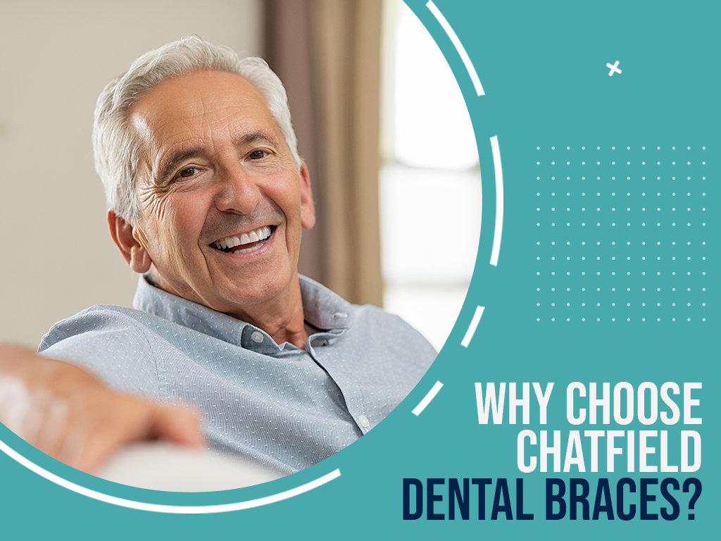  Why Choose Chatfield Dental Braces?