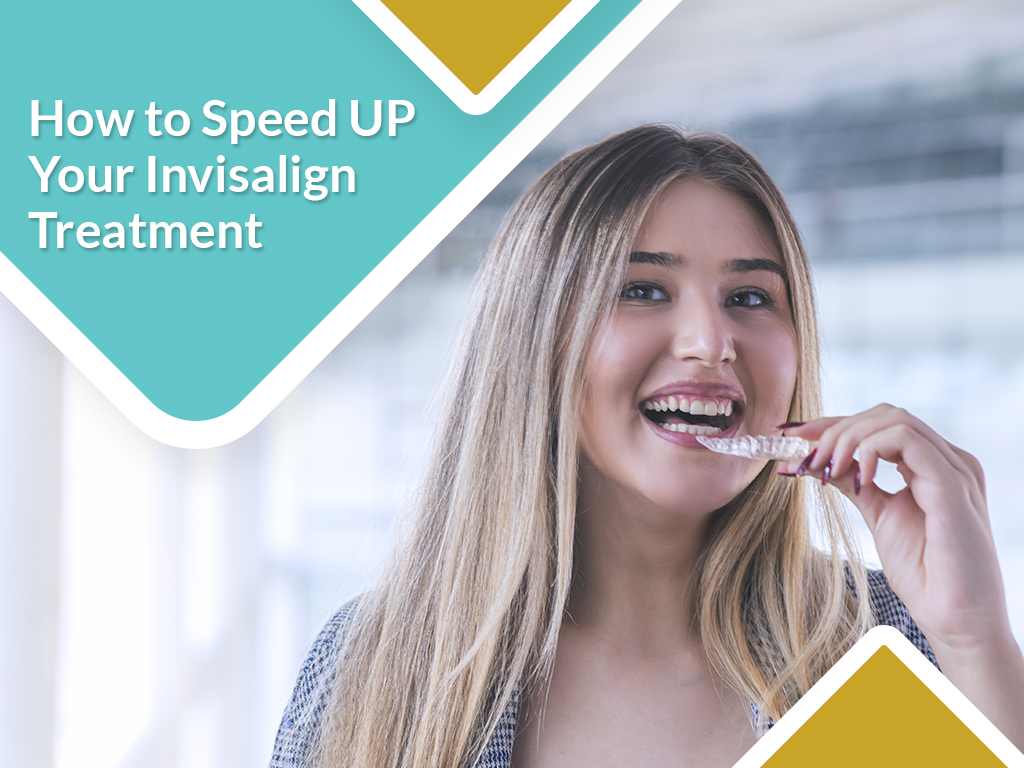  How to Speed up your Invisalign treatment?