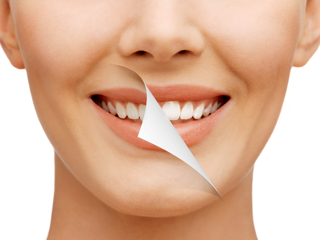  Myths and Truths about Teeth Whitening Treatment
