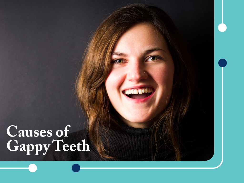 Causes of gappy teeth